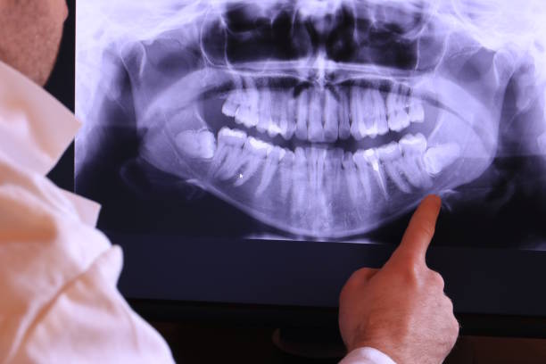 Best Emergency Gum Treatment in Brook Park, OH