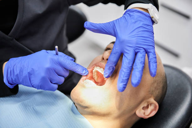 Best Emergency Dental Care for Broken or Chipped Teeth in Brook Park, OH